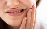 Болезни зуба