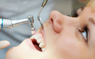 Что нельзя после чистки зубов