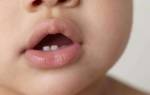 Понос на зубы у ребенка