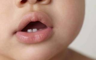 Понос при зубах у детей