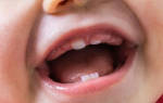 Сколько прорезывается первый зуб у малыша