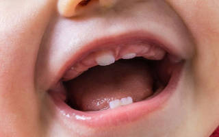 Сколько дней прорезаются первые зубы у детей