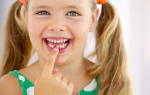 Смена зубов у детей возраст