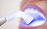 Сколько по времени пломбируют зуб