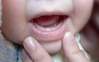 Зубы у детей до года симптомы