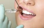 Линкомицина гидрохлорид в стоматологии