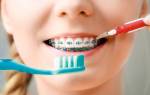 Как чистить зубы с брекетами зубной щеткой