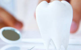 Что такое наращивание зуба