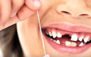 Не растет постоянный передний зуб у ребенка
