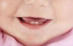 График прорезывания молочных зубов у детей