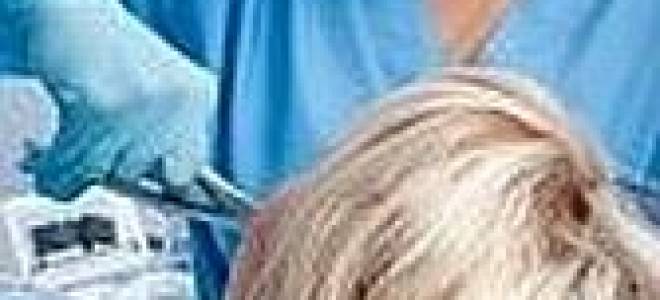 Можно ли есть перед удалением зуба мудрости