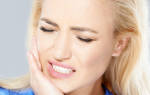 Народные средства от сильной зубной боли