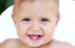 Гомеопатия при прорезывании зубов у детей
