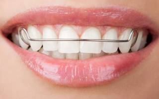 Пластины для зубов