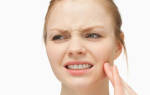 Болит щека после удаления зуба