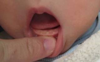 Когда появляются первые зубы у грудничка