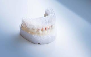 Выпрямление зубов без брекетов у взрослых