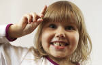 Смена молочных зубов у детей на постоянные