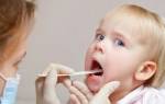 Средство от стоматита во рту у ребенка