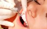 Как происходит чистка зубов в стоматологии