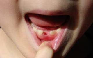 Какие молочные зубы выпадают у детей