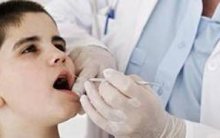 Что такое санация полости рта перед операцией