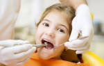 Как лечат пульпит молочных зубов у детей