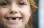 Какие зубы у детей не меняются