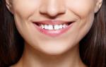 Как можно убрать щель между передними зубами
