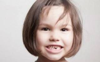 У ребенка после антибиотиков пожелтели зубы