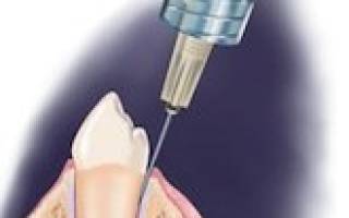Анестезия в стоматологии побочные эффекты