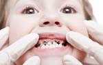 Зубы после серебрения