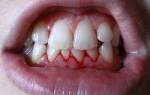 Вощеная или невощеная зубная нить