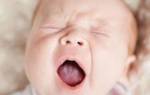 У новорожденного ребенка белый налет на языке