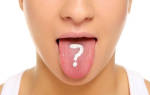 Что такое кандидоз полости рта