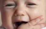 Снять боль при прорезывании зубов ребенка