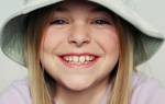 Порядок выпадения молочных зубов у детей