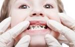 Почему у ребенка черные зубы