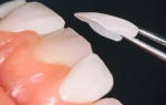 Белые наклейки на зубы