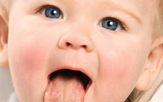 Как лечить стоматит во рту у ребенка