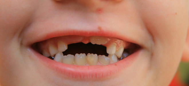 Какие зубы коренные у детей