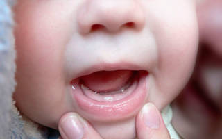 Какие первые зубы лезут у детей