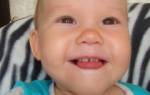 Серебрение зубов у детей комаровский