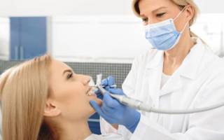 Что такое санирование полости рта