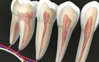 Воспаление нерва зуба симптомы