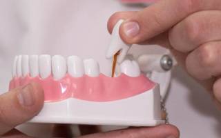 Протезирование зубов врач как называется